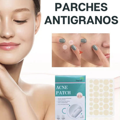 Parches Anti Acné Winner Discretos y Fáciles de Usar | KyM Emprendedores