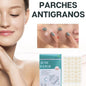 Parches Anti Acné Winner Discretos y Fáciles de Usar | KyM Emprendedores